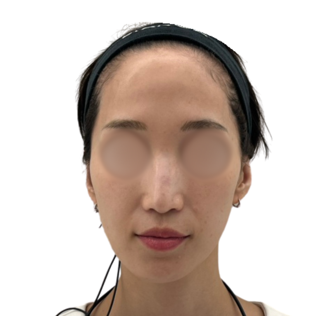 パーティーリフト（スマスアップネオ）